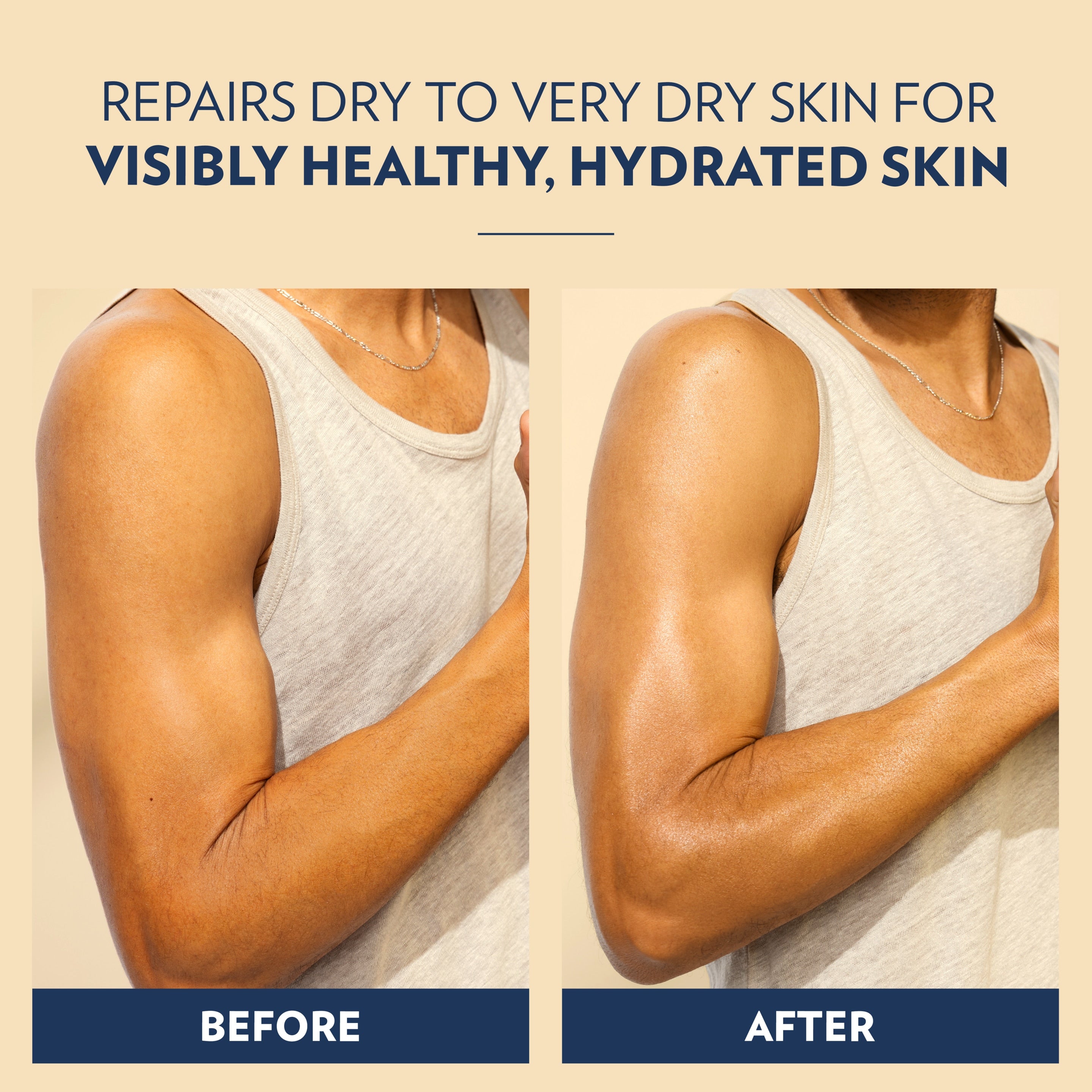 A side‑by‑side comparison of an arm before and after using Vaseline Men Extra Strength Lotion