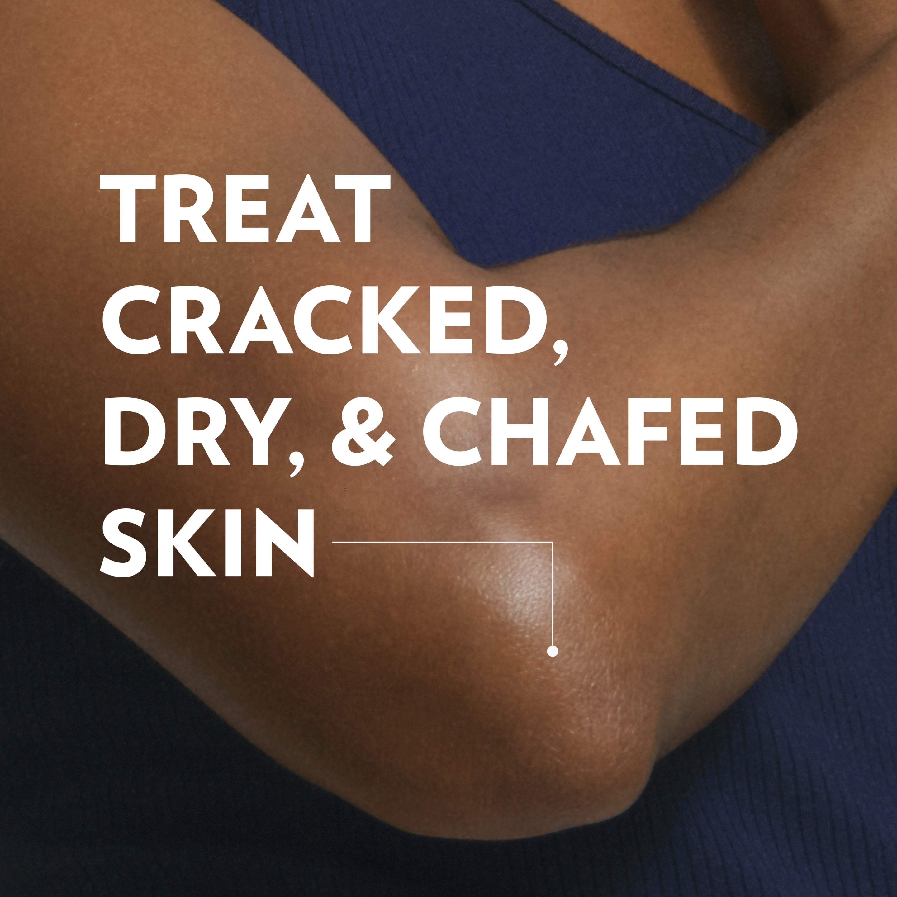 A close-up of a bent arm with a small spot highlighted is shown next to text