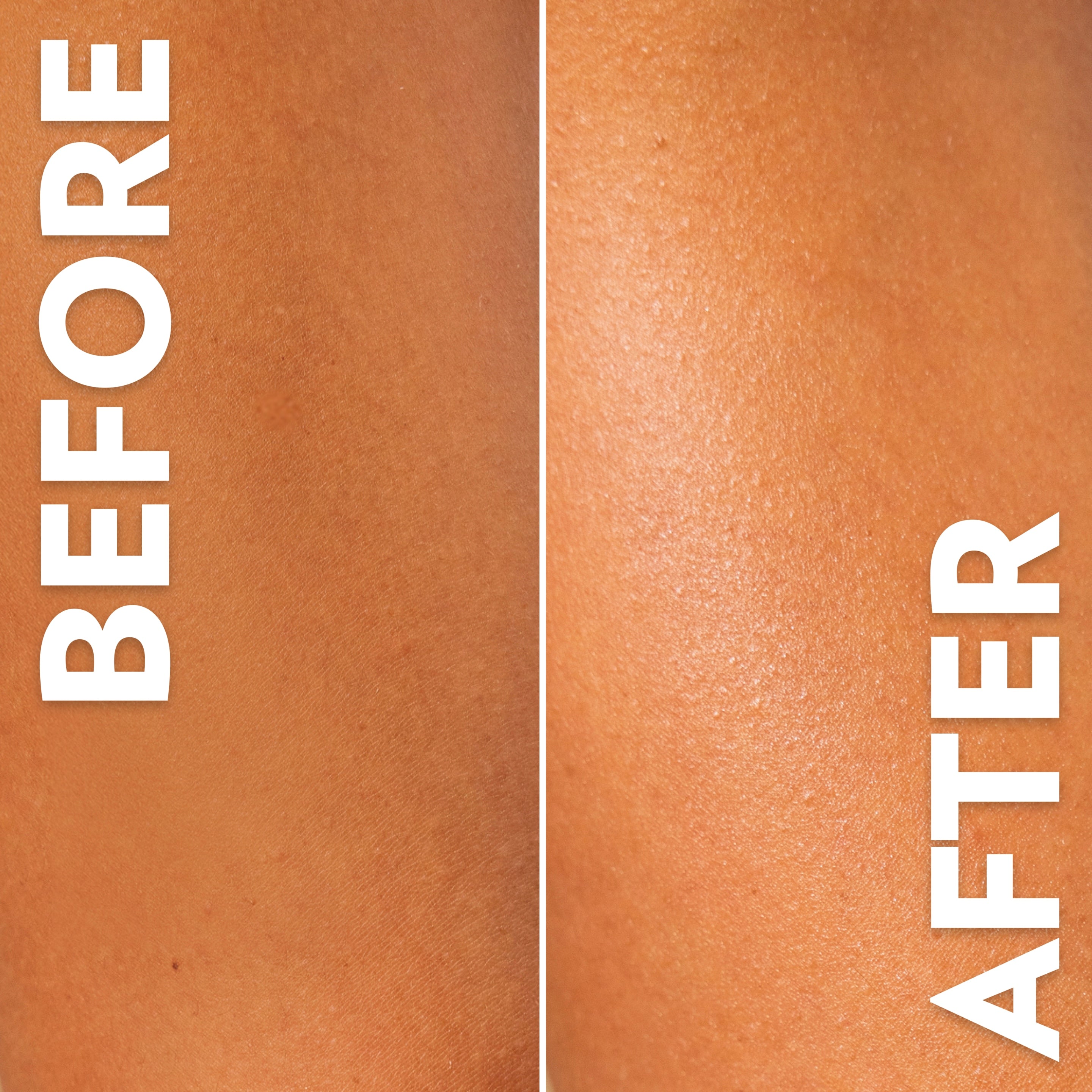 Side-by-side close-up comparison of skin labeled “Before” and “After,” showing smoother, more hydrated-looking skin texture in the after image.