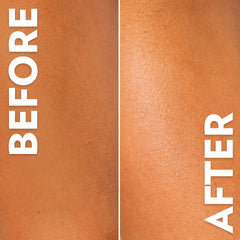 Side-by-side close-up comparison of skin labeled “Before” and “After,” showing smoother, more hydrated-looking skin texture in the after image.